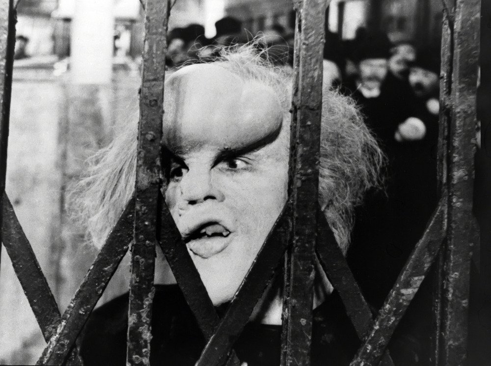 The Elephant Man